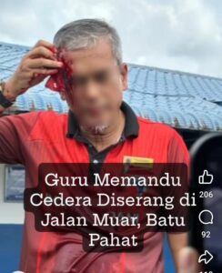 Guru sekolah memandu cedera diserang penunggang motosikal