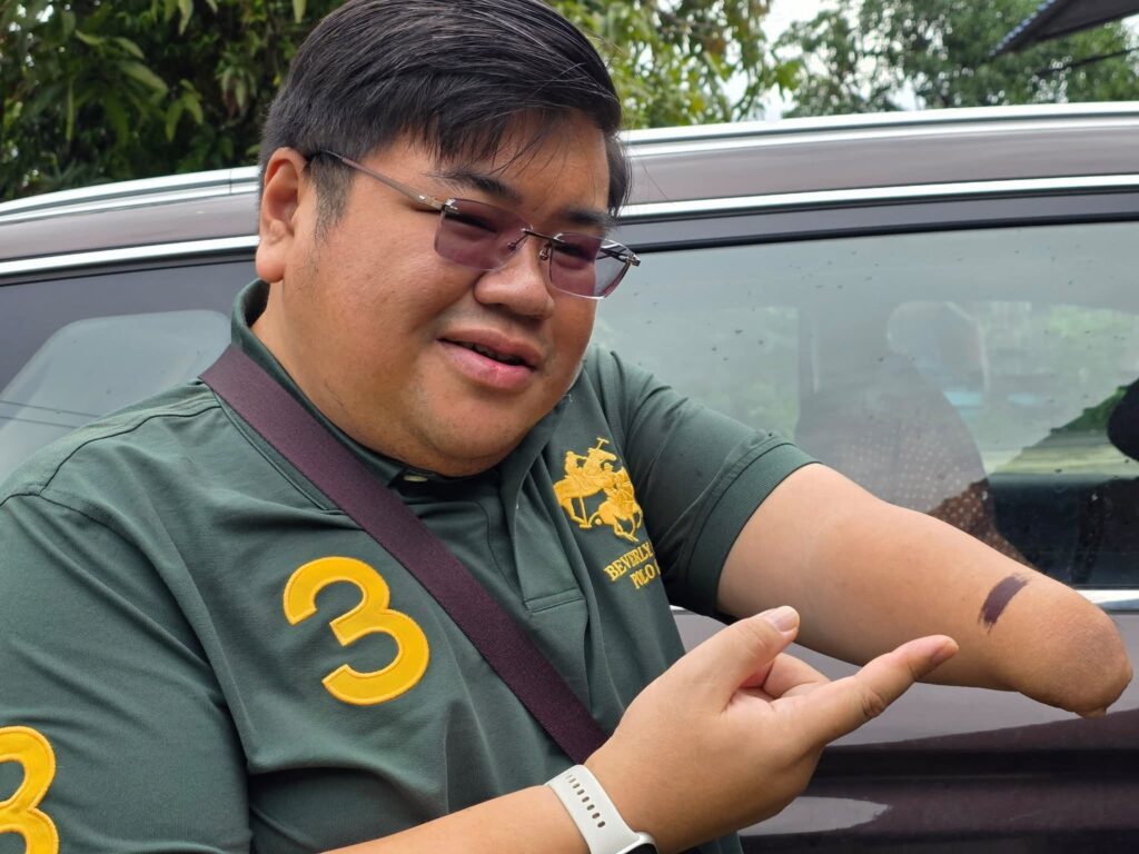 PRN Sabah: Pengundi OKU Dicalit Tanda Dakwat Pada Lengan Kiri